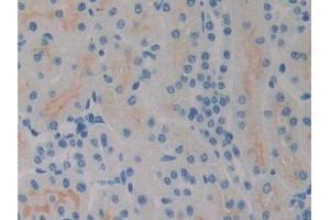 DAB staining on IHC-P; Samples: Rat Kidney Tissue (SPRY2 anticorps  (AA 116-304))