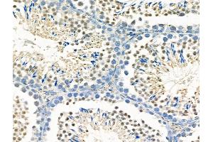 ABIN6259565 and ABIN6275780 at 1/100 staining Mouse testis tissue by IHC-P. (MX2 anticorps  (Internal Region))