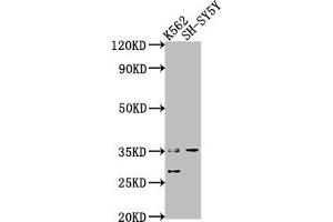 Western Blot Positive WB detected in: K562 whole cell lysate, SH-SY5Y whole cell lysate All lanes: THOC6 antibody at 1:2000 Secondary Goat polyclonal to rabbit IgG at 1/50000 dilution Predicted band size: 38, 35, 33 kDa Observed band size: 35 kDa (THOC6 anticorps  (AA 56-315))