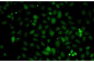 Immunofluorescence analysis of A-549 cells using C1S Polyclonal Antibody (C1S anticorps)