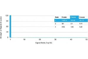 Analysis of Protein Array containing more than 19,000 full-length human proteins using PAPP-A Mouse Monoclonal Antibody (PAPPA/2715) Z- and S- Score: The Z-score represents the strength of a signal that a monoclonal antibody (MAb) (in combination with a fluorescently-tagged anti-IgG secondary antibody) produces when binding to a particular protein on the HuProtTM array.