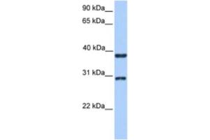 Western Blotting (WB) image for anti-Kelch Domain Containing 1 (KLHDC1) antibody (ABIN2463544) (KLHDC1 anticorps)