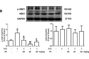 Paeoniflorin mimicked ASK1 inhibitor and decreased the phosphorylation of ASK1 in vivo. (ASK1 anticorps  (pThr845))