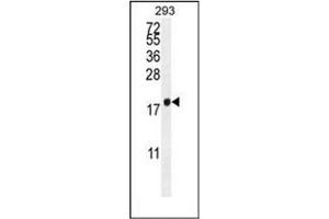 Western blot analysis of PCOTH Antibody (Center) in 293 cell line lysates (35ug/lane). (PCOTH anticorps  (Middle Region))