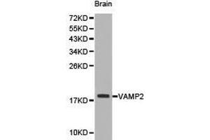 Western Blotting (WB) image for anti-Vesicle-Associated Membrane Protein 2 (Synaptobrevin 2) (VAMP2) antibody (ABIN1875306) (VAMP2 anticorps)