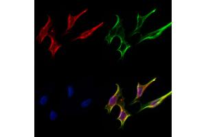 ABIN6264480 and ABIN6277000 staining Hela cells by IF/ICC. (PSMC3 anticorps  (Internal Region))