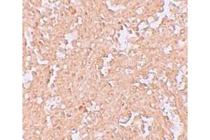Immunohistochemistry (IHC) image for anti-Zinc Finger and BTB Domain Containing 8A (ZBTB8A) (C-Term) antibody (ABIN1030814) (ZBTB8A anticorps  (C-Term))