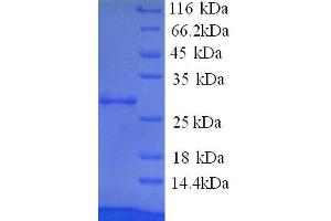 SDS-PAGE (SDS) image for Paraneoplastic Antigen MA2 (PNMA2) (AA 2-263), (partial) protein (His tag) (ABIN5713746)