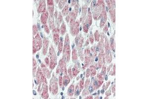 Immunhistochemistry analysis in human heart tissue (Formalin-fixed, Paraffin-embedded) using USP19 