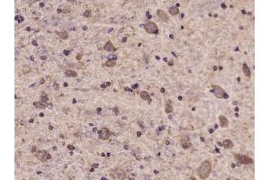 Paraformaldehyde-fixed, paraffin embedded rat brain Antigen retrieval by boiling in sodium citrate buffer (pH6.