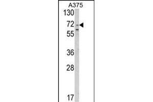 Western blot analysis of SLC23A2 Antibody (N-term) (ABIN652594 and ABIN2842398) in  cell line lysates (35 μg/lane).