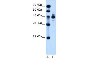 IHH antibody used at 1. (Indian Hedgehog anticorps)
