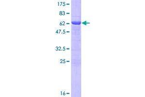 Image no. 1 for Uracil phosphoribosyltransferase (FUR1) Homolog (UPRT) (AA 1-309) protein (GST tag) (ABIN1324697)