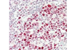 Formalin-fixed and paraffin-embedded H.