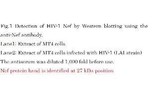 Western Blotting (WB) image for anti-HIV-1 Nef (full length) antibody (ABIN2452025) (HIV-1 Nef (full length) anticorps)
