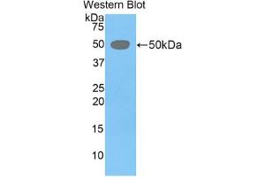 Western blot analysis of the recombinant protein. (LEFTY1 anticorps  (AA 169-368))