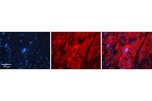 Rabbit Anti-HYAL1 Antibody   Formalin Fixed Paraffin Embedded Tissue: Human heart Tissue Observed Staining: Cytoplasmic Primary Antibody Concentration: 1:100 Other Working Concentrations: N/A Secondary Antibody: Donkey anti-Rabbit-Cy3 Secondary Antibody Concentration: 1:200 Magnification: 20X Exposure Time: 0.