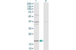 Western Blot analysis of FAU expression in transfected 293T cell line by FAU monoclonal antibody (M03), clone 3C10. (FAU anticorps  (AA 1-133))