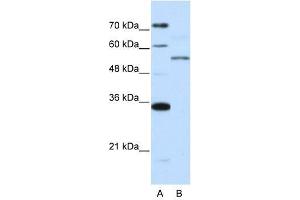 ZNF707 antibody used at 0. (ZNF707 anticorps  (N-Term))