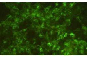 Fluorescence image of a culture of SiMa human neuroblastoma cells, pretreated for 12 h with 10 μg/ml of α-CJe, and after fixation stained for TH, revealing an intense cytoplasmic labeling in most of the cells (Campylobacter jejuni anticorps)