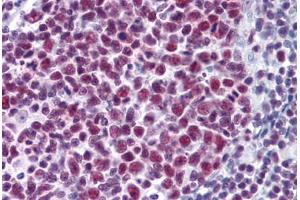 Human Tonsil: Formalin-Fixed, Paraffin-Embedded (FFPE)