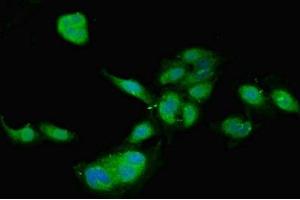 Immunofluorescent analysis of Hela cells using ABIN7159497 at dilution of 1:100 and Alexa Fluor 488-congugated AffiniPure Goat Anti-Rabbit IgG(H+L) (TIMP4 anticorps  (AA 31-224))