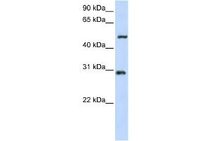 WB Suggested Anti-ZNF138 Antibody Titration:  0. (ZNF138 anticorps  (N-Term))