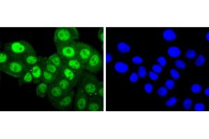 MCF-7 cells were fixed with paraformaldehyde, permeabilized with 0. (PKC alpha anticorps  (pThr638))