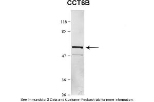 Sample Type: HEK 293 (10ug)Primary Dilution: 1:1000Secondary Antibody: conjugated goat anti-rabbitSecondary Dilution: 1:10,000Image Submitted By: Amy GrayBrigham Young University