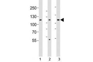 Western blot analysis of lysate from 1) HT-29, 2) HeLa, and 3) Jurkat cell line using JAK1 antibody (JAK1 anticorps  (N-Term))