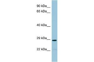 WB Suggested Anti-NAT8B Antibody Titration:  0. (NAT8B anticorps  (Middle Region))