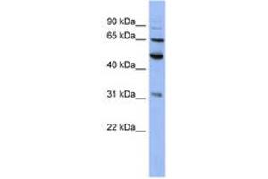 Image no. 1 for anti-Proteasome (Prosome, Macropain) 26S Subunit, Non-ATPase, 3 (PSMD3) (AA 107-156) antibody (ABIN6744086) (PSMD3 anticorps  (AA 107-156))