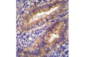 Formalin fixed and paraffin embedded human uterus tissue stained with Cyclooxygenase 2 Antibody (Center) followed by peroxidase conjugation of the secondary antibody and DAB staining