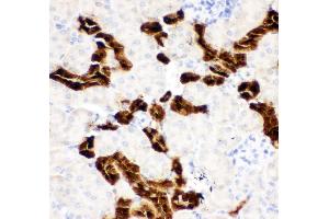 Anti-Calbindin Picoband antibody,  IHC(P): Mouse Kidney Tissue (CALB1 anticorps  (AA 2-175))