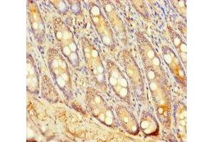Immunohistochemistry of paraffin-embedded human small intestine tissue using ABIN7174635 at dilution of 1:100 (UGT2A3 anticorps  (AA 201-491))