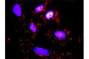 Proximity Ligation Analysis of protein-protein interactions between STK11 and RPS6KB1.