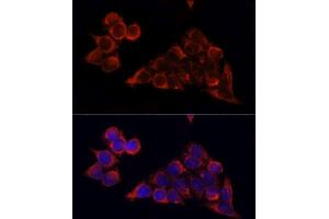 Immunofluorescence analysis of HeLa cells using MTOR antibody.