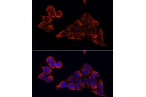 Immunofluorescence analysis of HeLa cells using MTOR antibody. (MTOR anticorps  (AA 2400-2500))