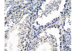 Phospho-ASK1 (Thr845) Antibody at 1/100 staining Mouse testis tissue by IHC-P.