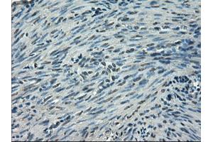Immunohistochemical staining of paraffin-embedded endometrium tissue using anti-SLC2A5mouse monoclonal antibody.
