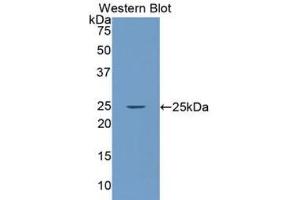 Western blot analysis of the recombinant protein. (LAMa4 anticorps  (AA 832-1039))