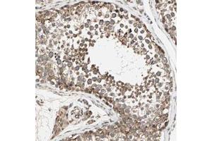 Immunohistochemical staining of human testis with ZNF37A polyclonal antibody  shows cytoplasmic positivity in cells of seminiferus ducts at 1:20-1:50 dilution. (ZNF37A anticorps)