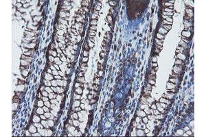 Image no. 2 for anti-SKI-Like Oncogene (SKIL) (AA 307-684) antibody (ABIN1491380)