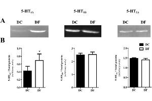 5-HT1A/1D/2A receptor expression in thoracic aortas from control (DC) and fluoxetine-treated (DF) diabetic rats by Western blot. (Serotonin Receptor 1A anticorps  (AA 301-400))