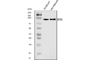 Western blot analysis of Glycogen synthase 1/GYS1 using anti-Glycogen synthase 1/GYS1 antibody (ABIN7602155).