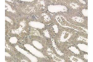 ABIN6256137 and ABIN6267203 at 1/100 staining human normal kidney tissue by IHC-P. (Tuberin anticorps  (pSer1387))