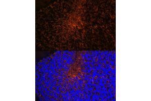 Immunofluorescence analysis of mouse brain using Aquaporin-4 (Aquaporin-4 ) Rabbit mAb (ABIN7265653) at dilution of 1:100 (40x lens).