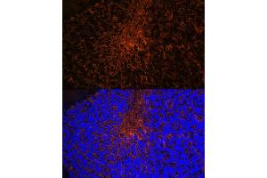 Immunofluorescence analysis of mouse brain using Aquaporin-4 (Aquaporin-4 ) Rabbit mAb (ABIN7265653) at dilution of 1:100 (40x lens).