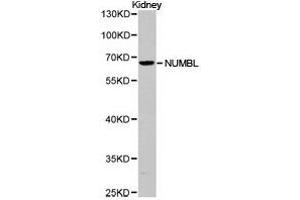 Western Blotting (WB) image for anti-Numb Homolog (Drosophila)-Like (NUMBL) antibody (ABIN1873987) (NUMBL anticorps)