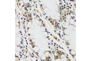 Immunohistochemistry of paraffin-embedded human colon using C antibody (ABIN6127552, ABIN6137952, ABIN6137953 and ABIN6216977) at dilution of 1:100 (40x lens). (CASC5 anticorps  (AA 1-300))